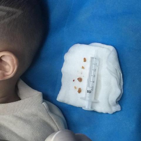 【沈阳一确诊病例为医院护士/沈阳新增病例护士】