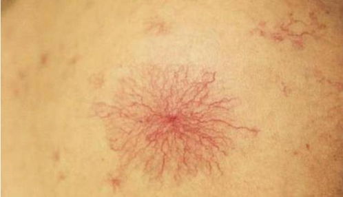 青岛无症状者属早期感染,青岛疫情无症状