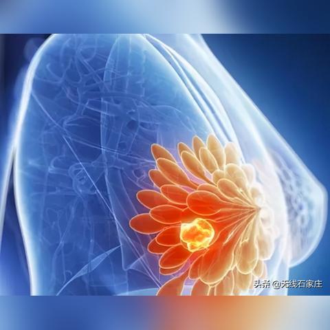 石家庄鹿泉新增4例确诊-石家庄鹿泉疑似病例